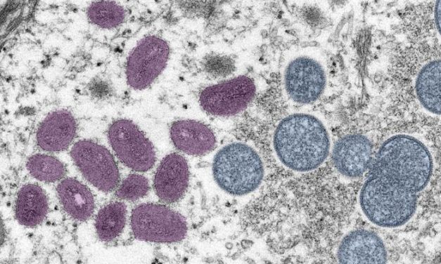 DHS expands monkeypox vaccine eligibility