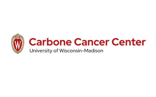 UW Carbone Cancer Cancer receives federal boost for prostate cancer treatment